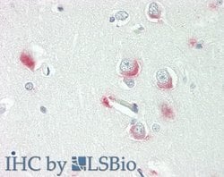 WASF1/WAVE1 Antibody, Novus Biologicals 100 &mu;L | Buy Online | Novus Biologicals | Fisher Scientific